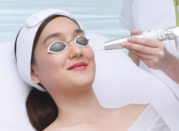 femme faisant un bleaching au duvet avec lunettes de protection